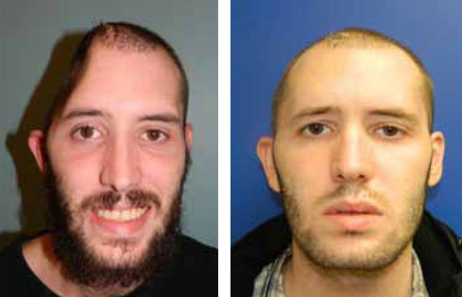 Multidisciplinary Adult Cranioplasty Center Johns Hopkins Medicine