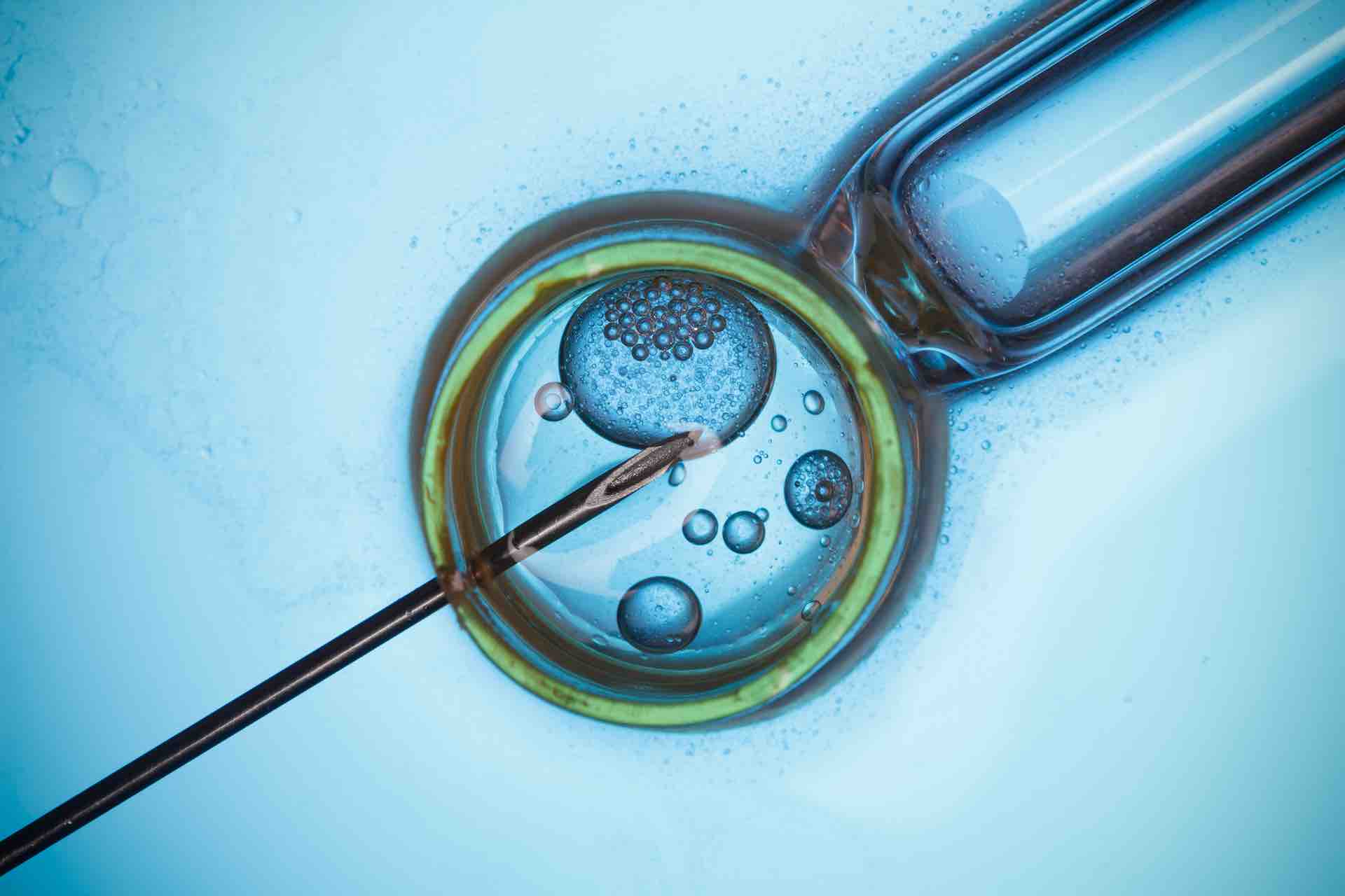 A rendering of in vitro fertilization shows a black needle puncturing a round egg being held in a circular device on a blue background.