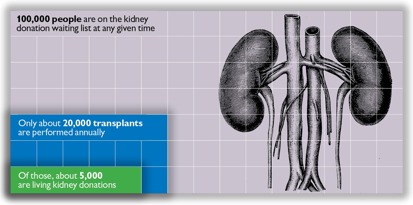 Kidney Stats