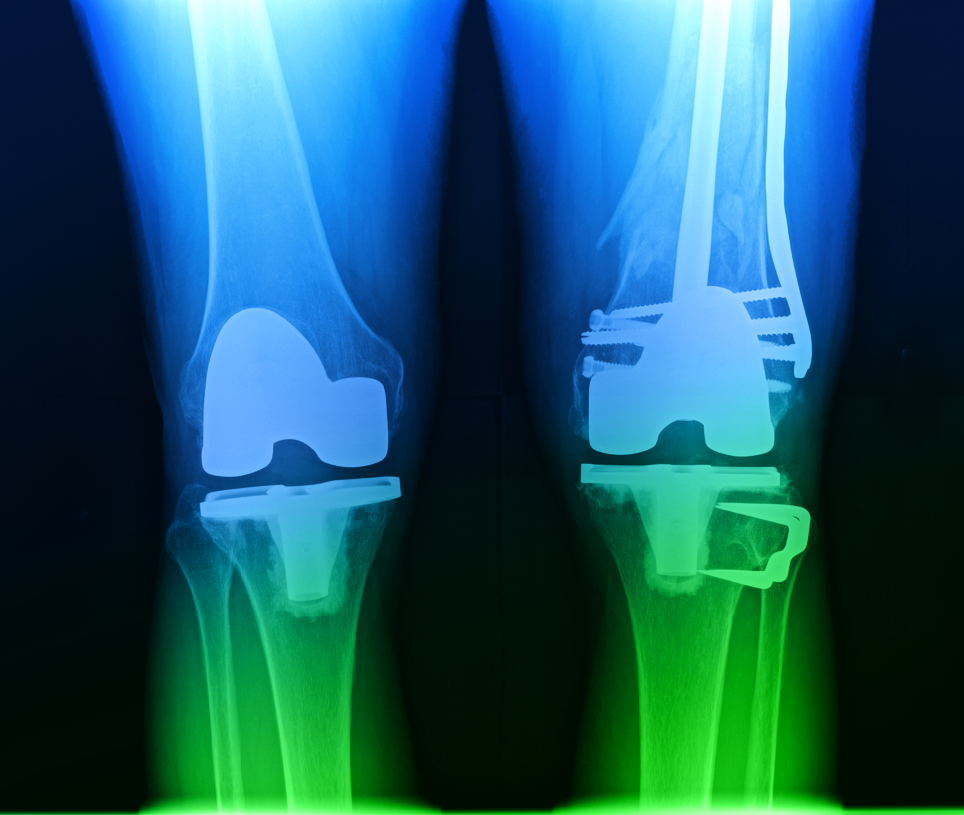 Sports Medicine UT Southwestern Medical Center