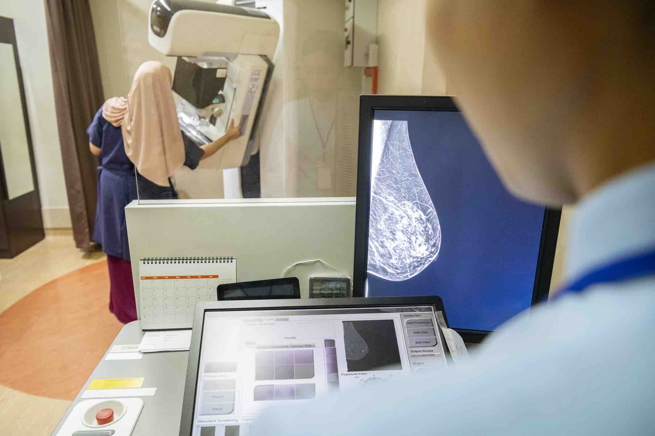 Screening Mammography Guidelines Johns Hopkins Medicine