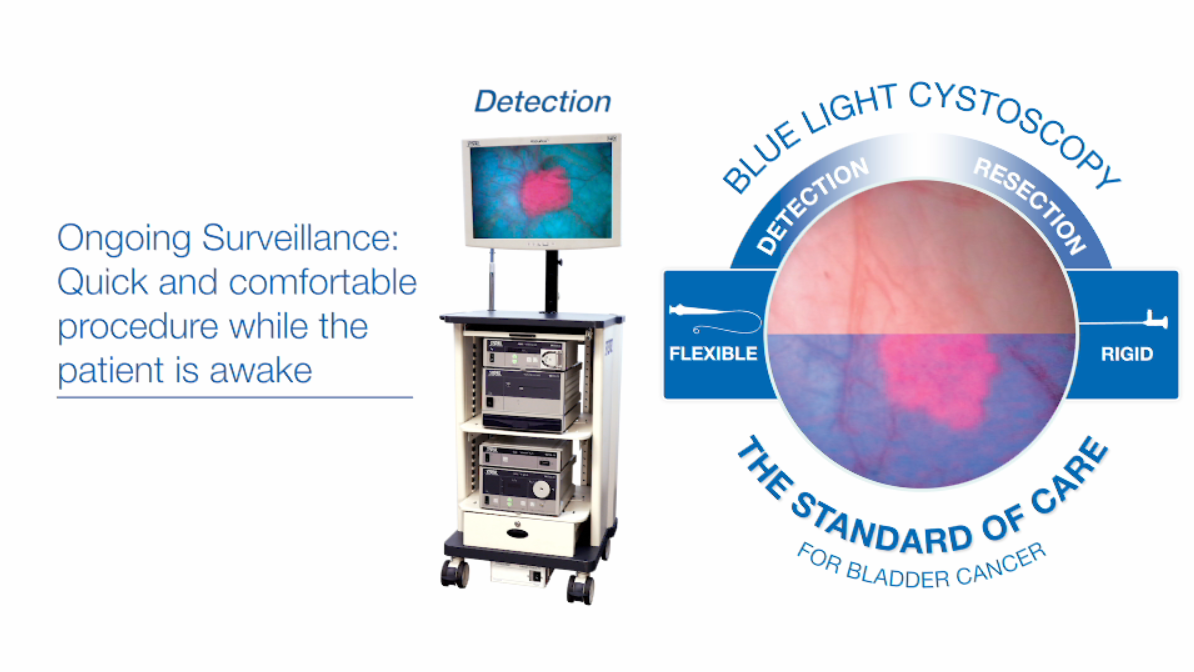 Using KARL STORZ Blue Light Cystoscopy with Cysview Karl Storz