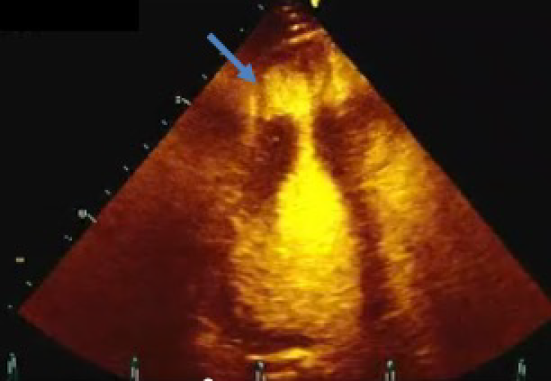 J.	(Figure 10)