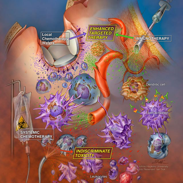 neuro illustration