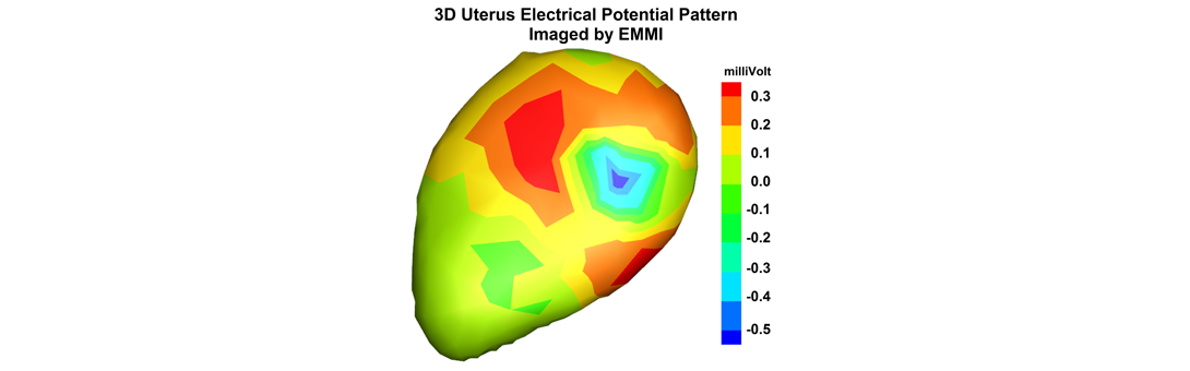 EMMI images of uterine contractions in women