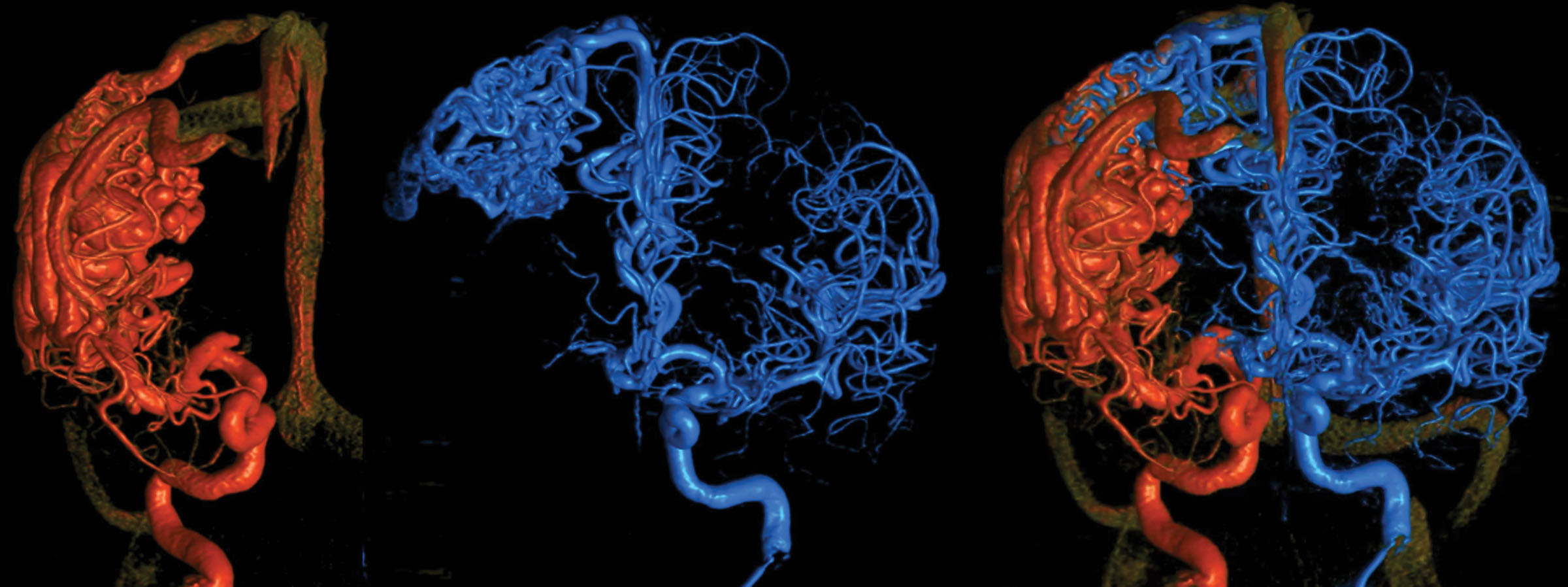 UT Southwestern's cornea specialists are experts in neurotization surgery.