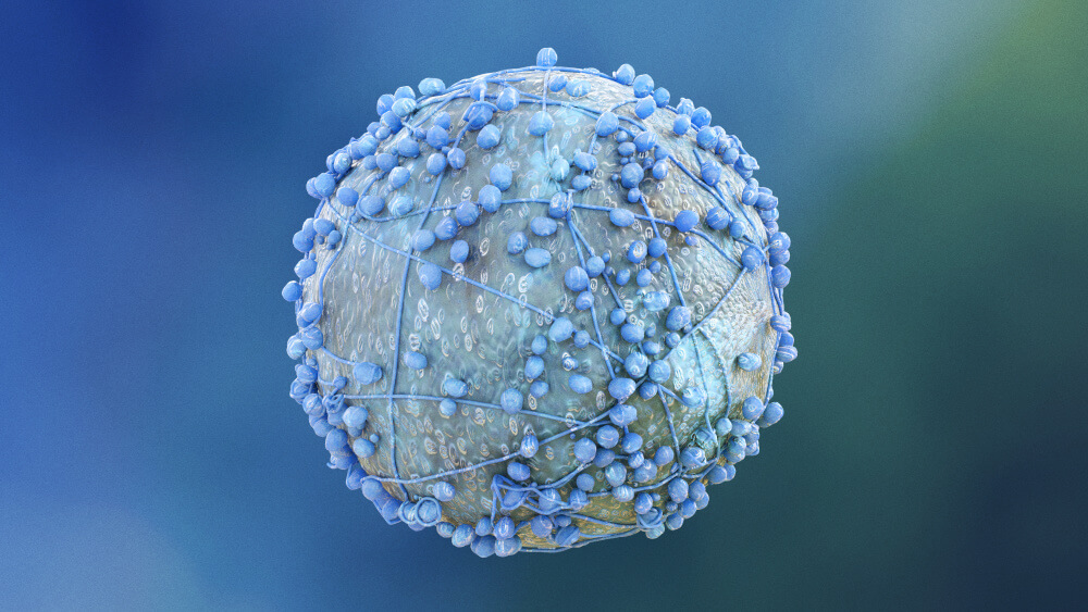 A pancreatic cancer cell.