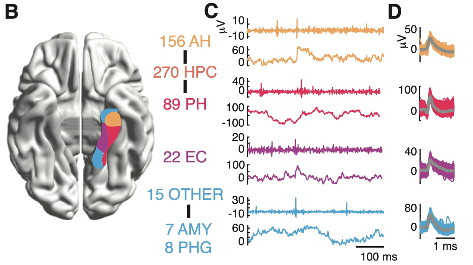 Brain Activity