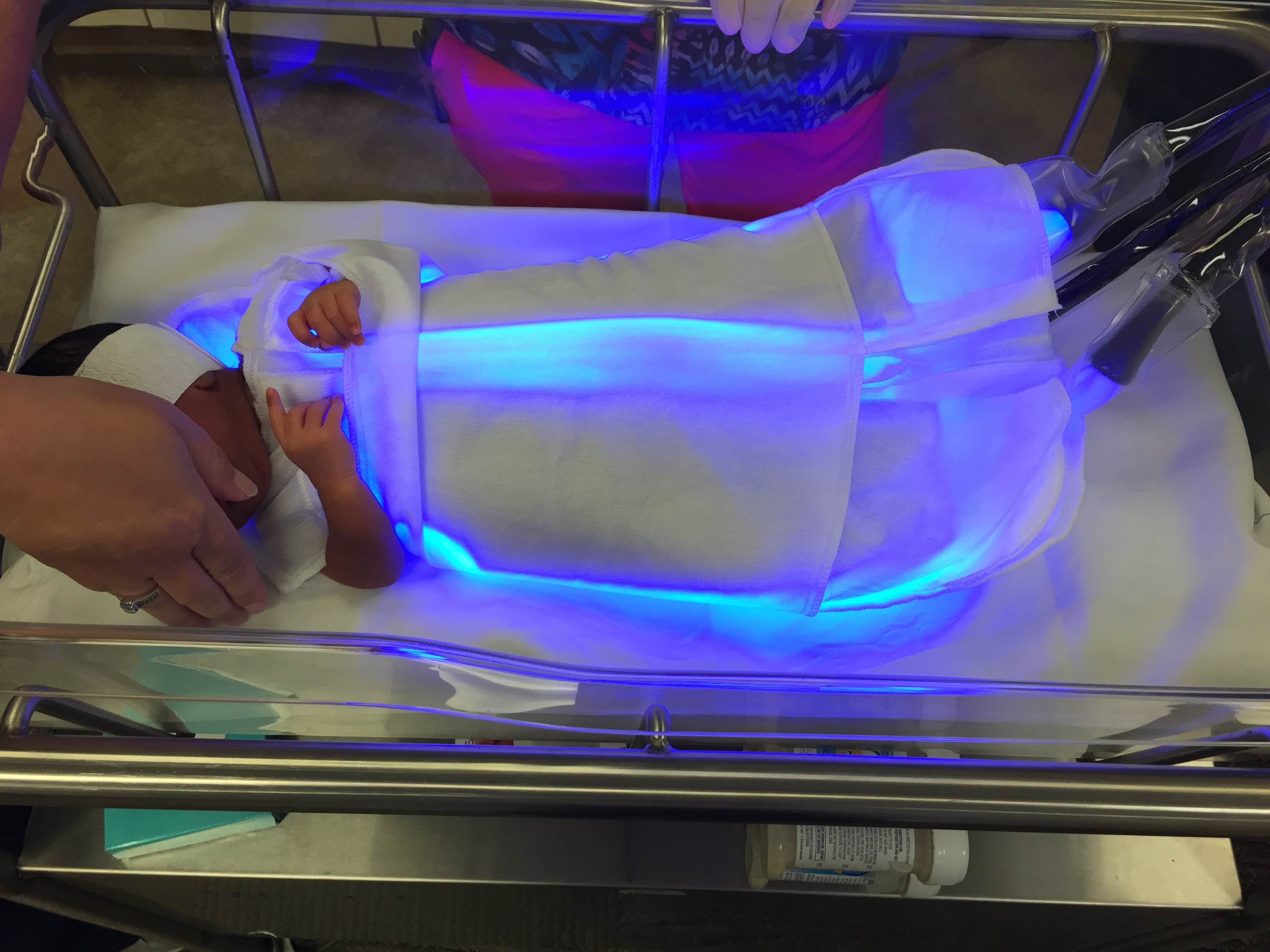 light for newborn jaundice