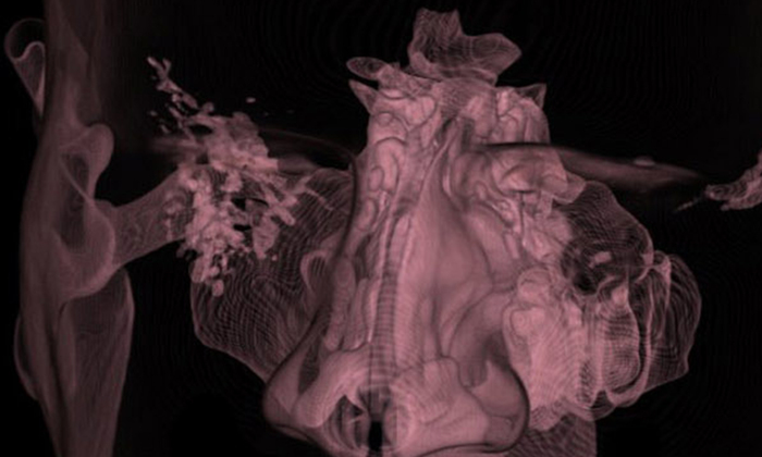 a 3D illustration of the nervous system in relation to the spine and brain, with nerves, the brain and spine glowing amber