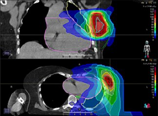 Basic anatomy & Radiology for breast cancer case