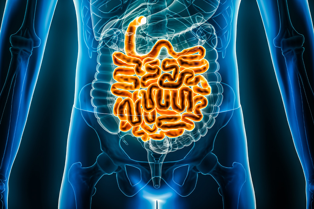 inflammatory bowel disease