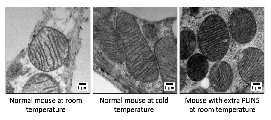 With extra PLIN5, mitochondria in brown fat cells boost their capacity to burn fat even at room temperature. Images by Drs. Violeta I. Gallardo-Montejano and Perry E. Bickel.