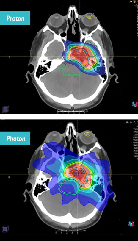 proton-photon1