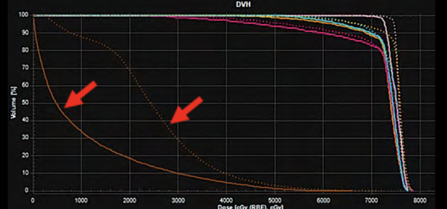 radiation dose chart