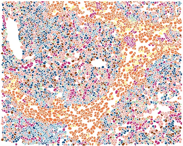 Spatial transcriptomics