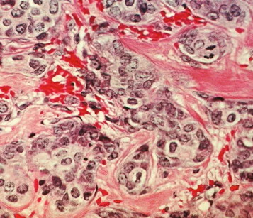 Cells