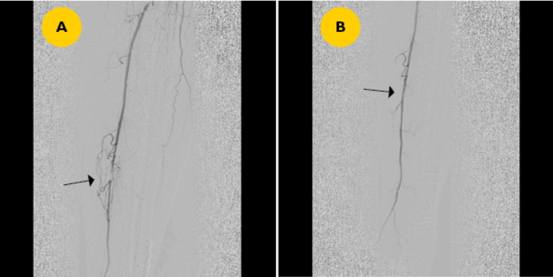 vascular image